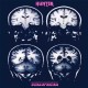 HUNTER-SCHIZOPHRENIA (7")