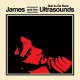 JAMES AND THE ULTRASOUNDS-BAD TO BE HERE (CD)