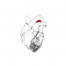SWANS-BEGGAR (2LP)