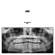 JACK VAN CLEAF-JVC (2LP)